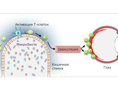 Кишечные микробы могут вызывать заболевания глаз