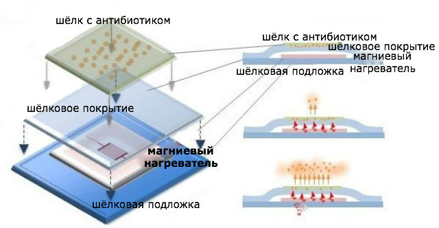 Схема растворяемого имплантата (иллюстрация Tufts University/перевод Вести.Наука).