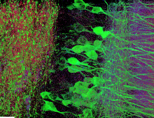 Так выглядит увеличенный гиппокамп мыши (фото Fei Chen, Paul Tillberg, Ed Boyden/MIT).