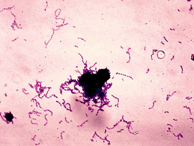 Колония бактерий S. mutans, вызывающих кариес (фото PHIL/Wikimedia Commons).