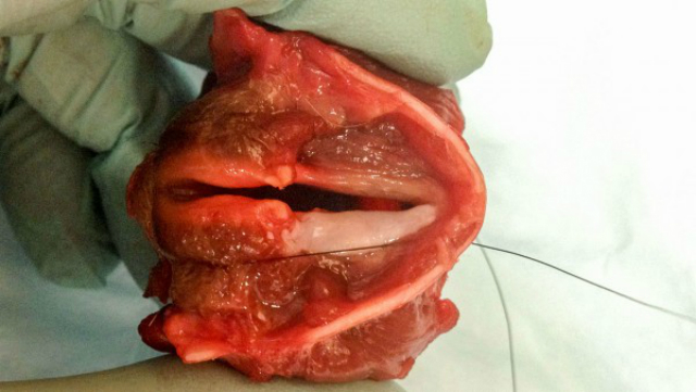 Учёные имплантировали инженерные ткани (светлого цвета на нижних голосовых связках) в гортань мёртвой собаки, чтобы проверить, насколько хорошо она вибрирует и производит звук (фото Nathan Welham, University of Wisconsin, Madison).