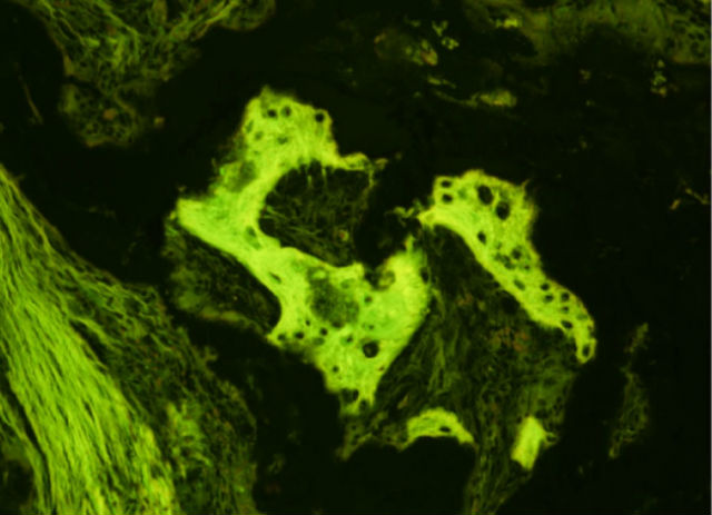 Костная ткань, сформированная из ИПК у макаки-резуса (фото Cynthia Dunbar, Cell Reports). 