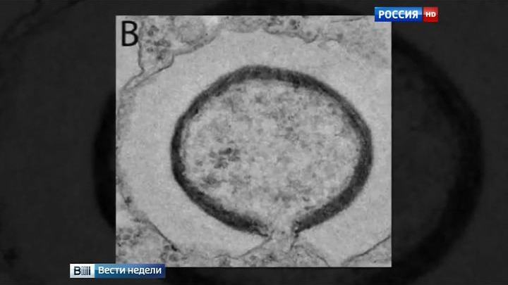 Ученые оживили древний вирус, убивший мамонтов и динозавров